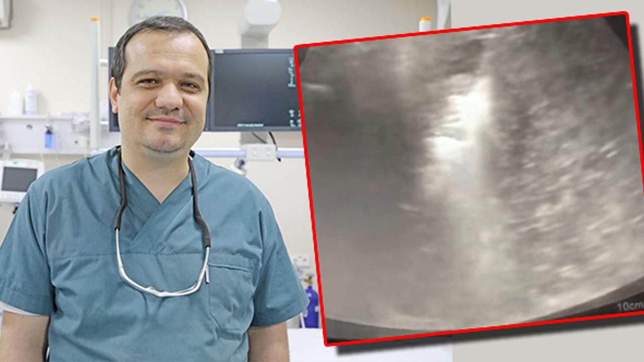 Tümörü 10 dakikada yok ettiler!