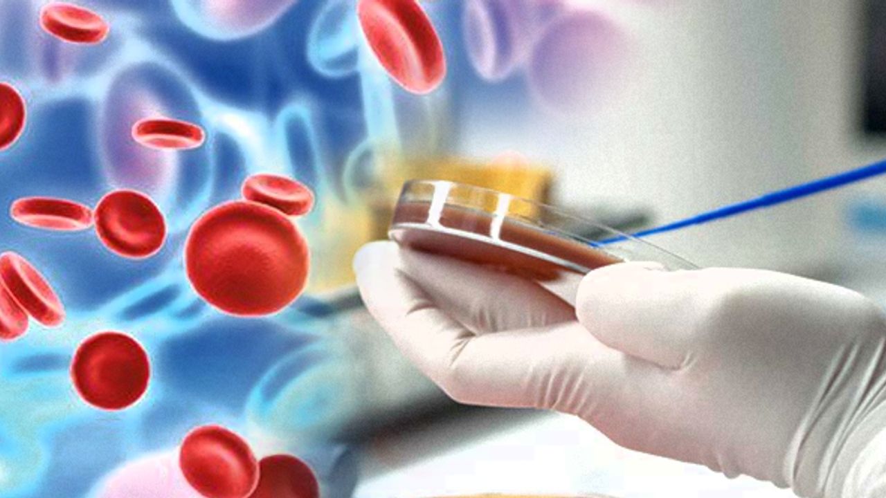 Eskişehir Sağlık Müdürlüğü'nden Sepsis uyarısı.. Sepsis nedir? Belirtileri nelerdir?